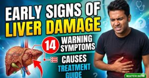 Early Signs of Liver Damage